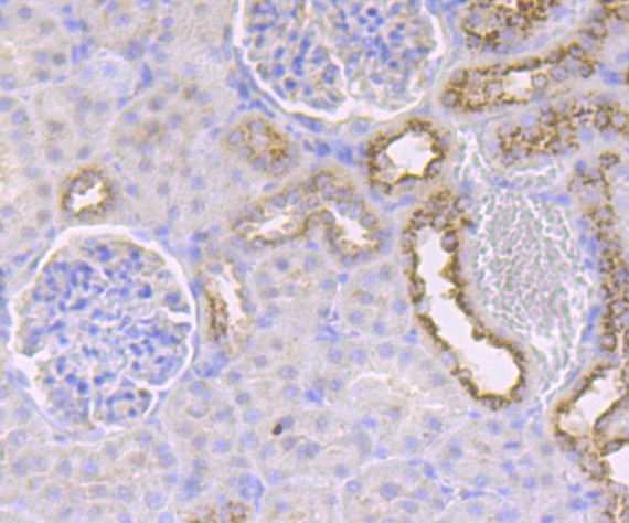Anti-IMPDH2 Antibody (7R923)