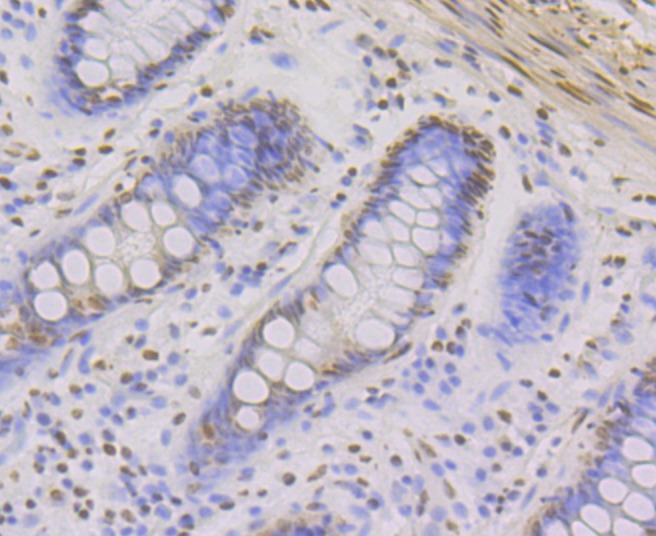 Anti-ILF3 Antibody (8T791)