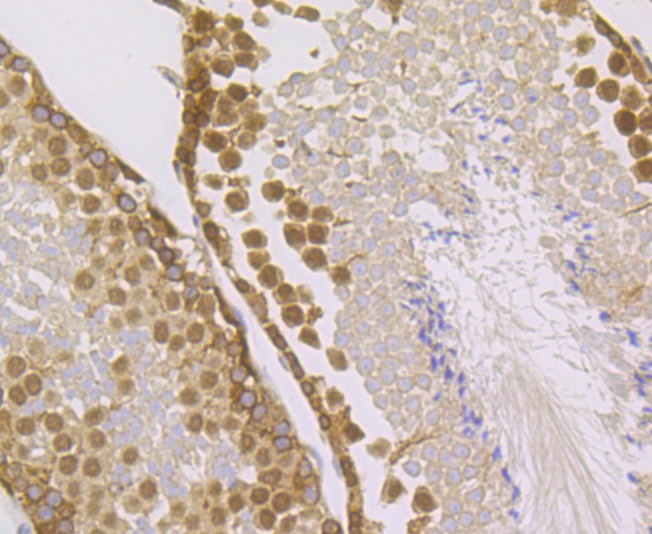 Anti-IMPDH2 Antibody (7R923)