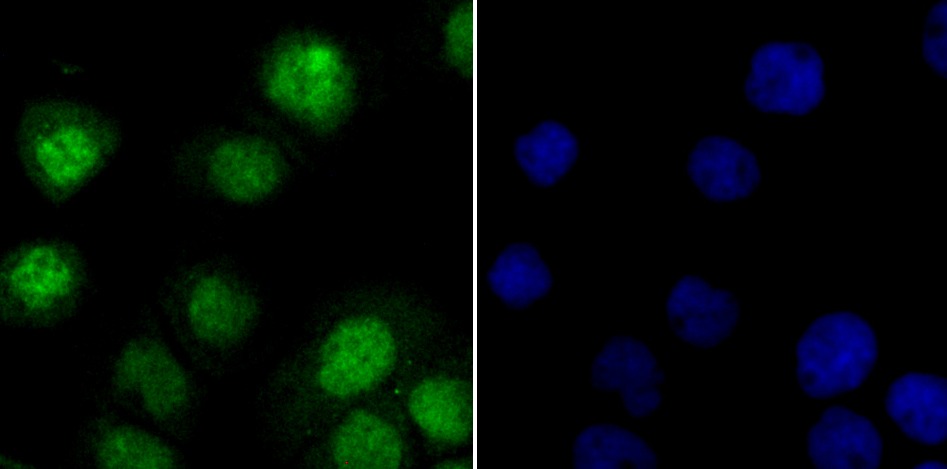 Anti-ILF3 Antibody (8T791)