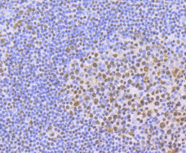 Anti-ILF3 Antibody (8T791)
