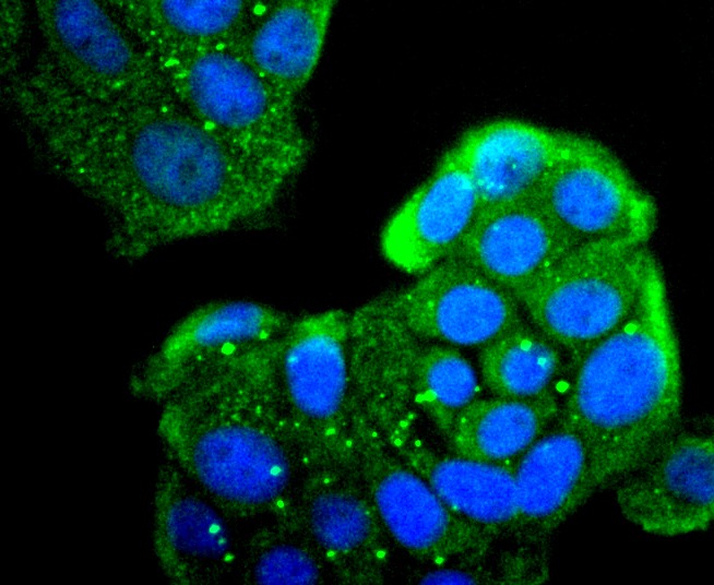 Anti-MRC1 Antibody (6M291)