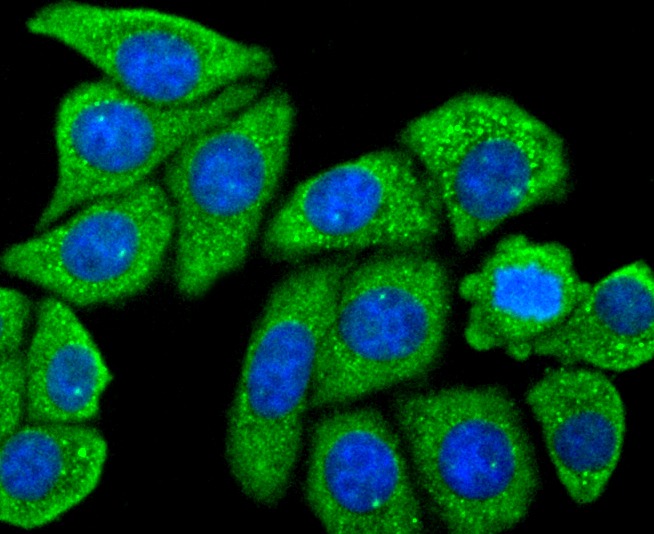 Anti-MRC1 Antibody (6M291)