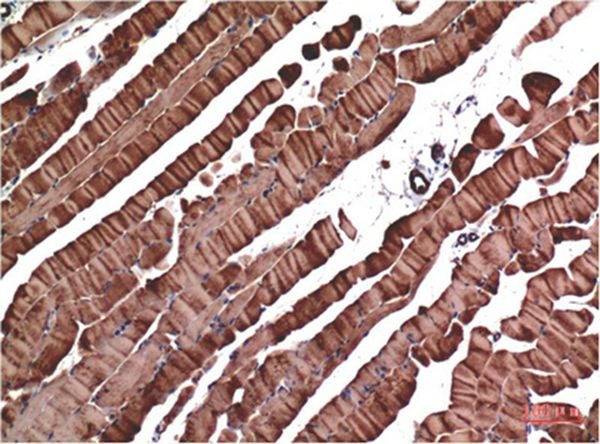 Anti-ACTA1 Antibody (5P964)