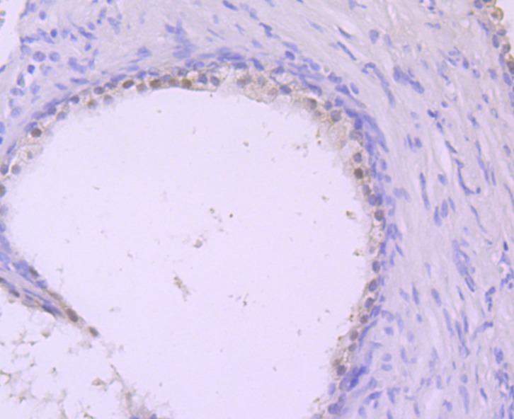 Anti-MVP Antibody (8H895)