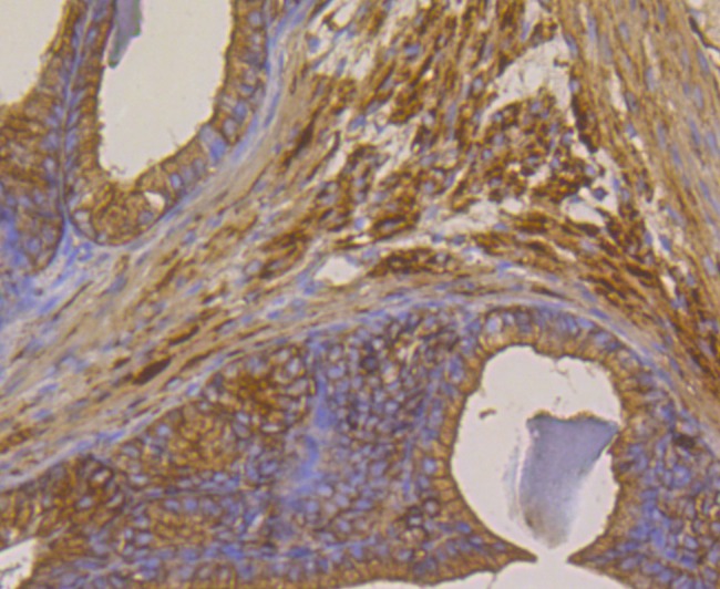 Anti-METAP2 Antibody (2D279)