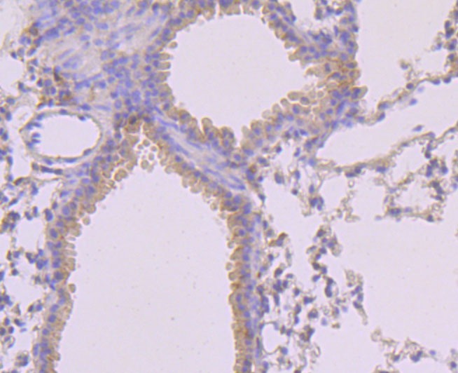 Anti-Phospho-MLKL (S345) Antibody (6R72)