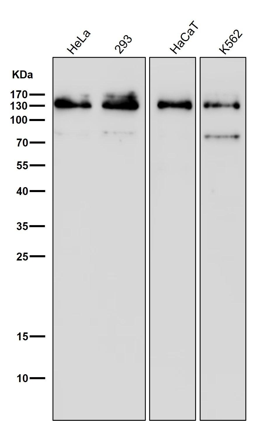 Anti-MGEA5 Antibody (9D447)