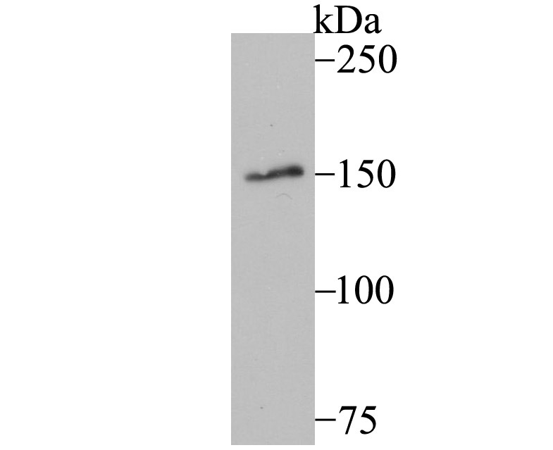 Anti-MYBBP1A Antibody (3Q540)