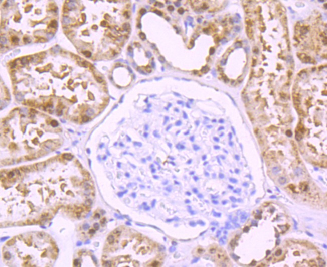 Anti-MVP Antibody (8H895)