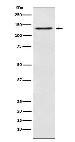 Anti-MGEA5 Antibody (9D447)