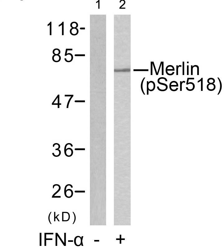 Anti-Phospho-Merlin (Ser518) Polyclonal Antibody 2