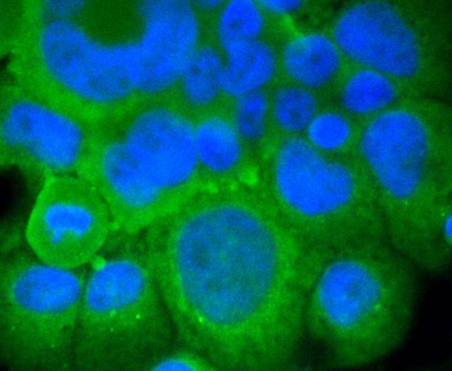 Anti-GRM5 Antibody (8K741)
