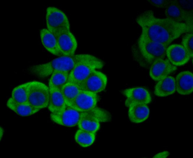 Anti-METAP2 Antibody (2D279)