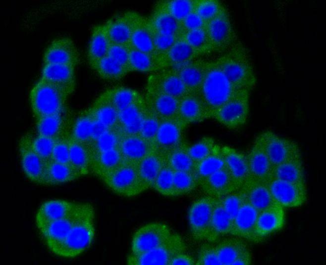 Anti-GRM5 Antibody (8K741)