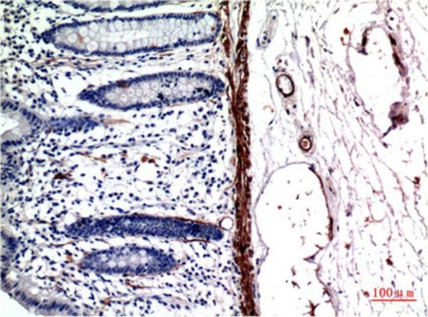Anti-ACTA1 Antibody (8A2)