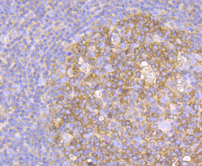Anti-METAP2 Antibody (2D279)
