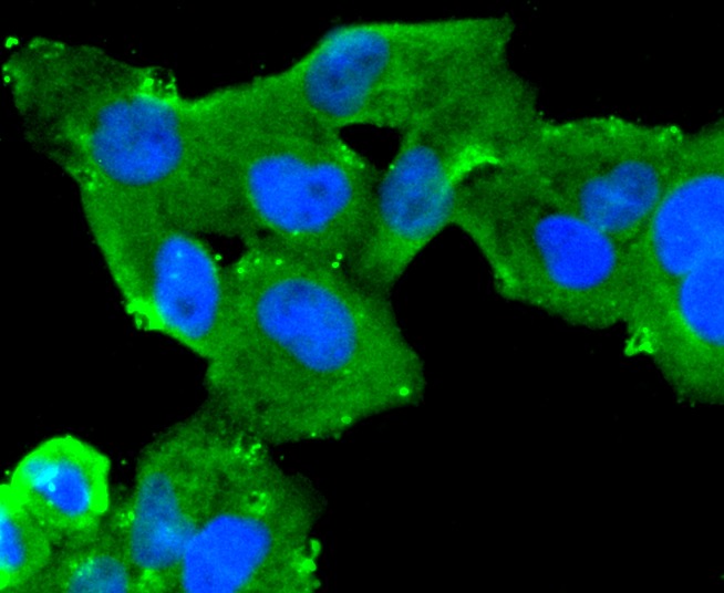 Anti-Mucin-16/MUC16 Antibody (2J784)