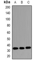 Anti-Phospho-MKI67IP (Thr234) Polyclonal Antibody