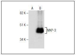 Anti-MKP-3 Antibody (2L119)