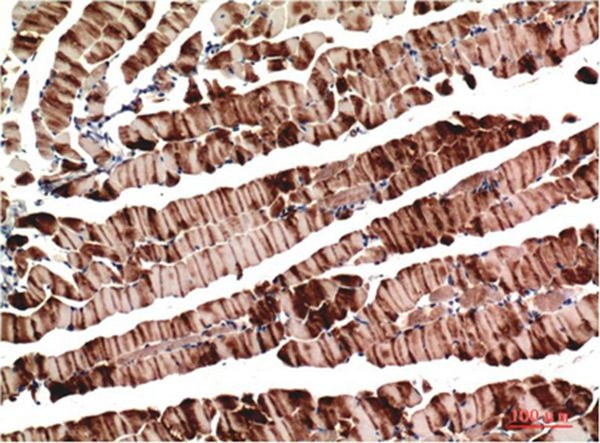 Anti-ACTA1 Antibody (6X341)