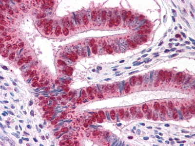 Anti-IRF4 Antibody (7S662)