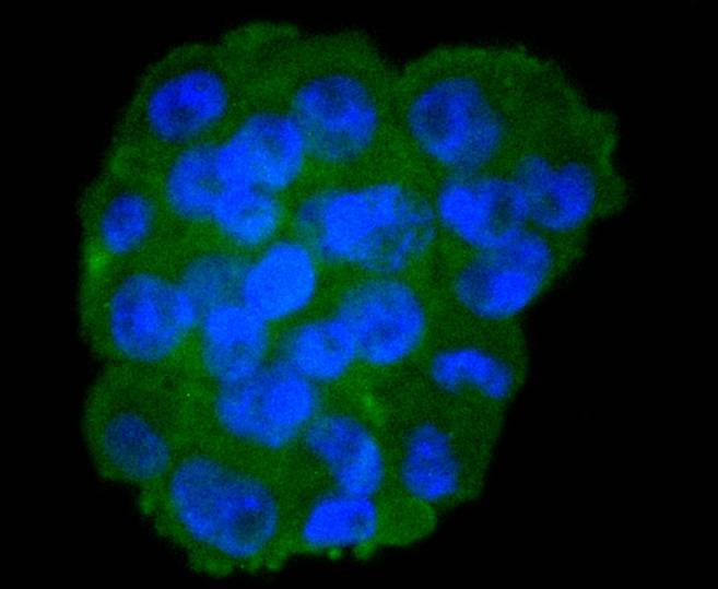 Anti-Moesin Antibody (2Z70)