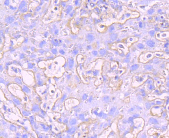 Anti-MMP-9 Antibody (5C993)