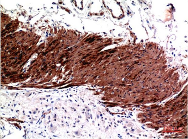 Anti-ACTA1 Antibody (6X341)