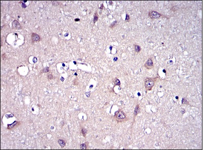 Anti-MMP-9 Antibody (7Q238)