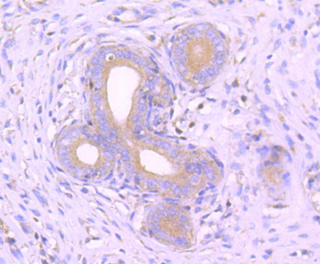 Anti-MAP3K3 Antibody (2Q519)