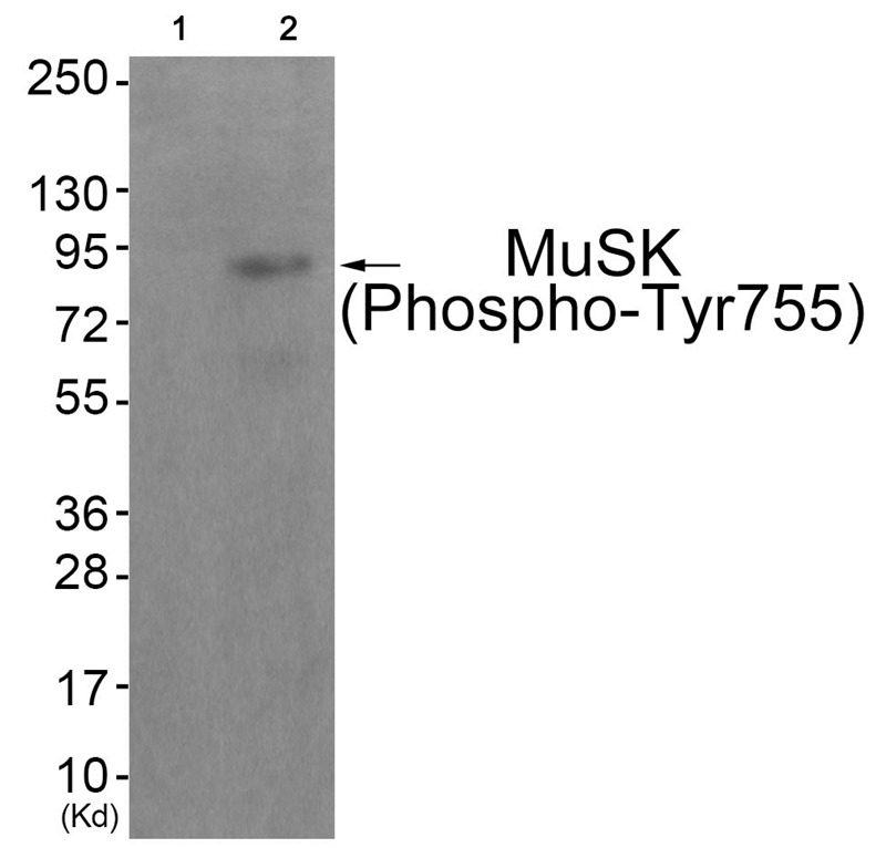 Anti-Phospho-MUSK (Tyr755) Polyclonal Antibody