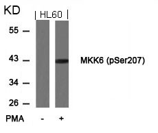 Anti-Phospho-MKK6 (Ser207) Polyclonal Antibody