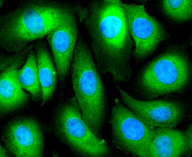 Anti-Mucin-16/MUC16 Antibody (2J784)