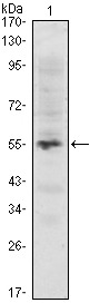 Anti-IRF4 Antibody (7S662)