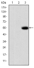 Anti-MMP-9 Antibody (7Q238)