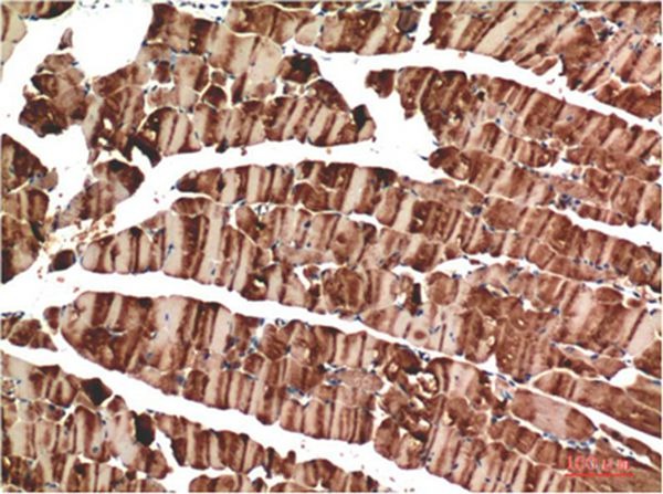 Anti-ACTA1 Antibody (8A2)