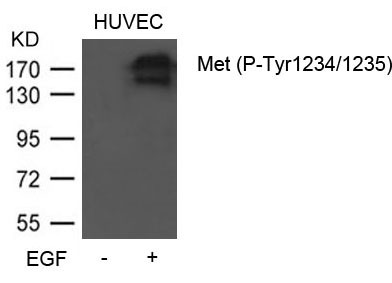 Anti-Phospho-HGFR/c-Met (Tyr1234, 1235) Polyclonal Antibody