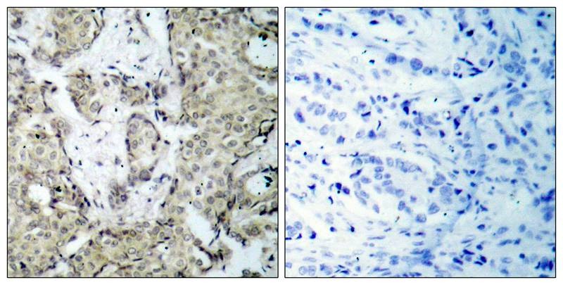 Anti-MAP2K3 Polyclonal Antibody