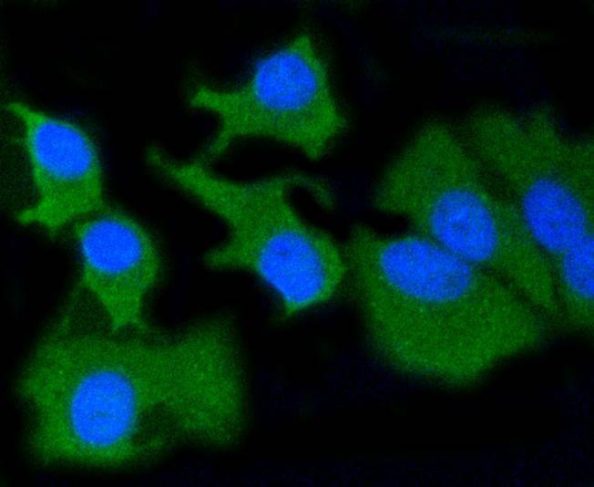 Anti-MMP-14 Antibody (7I45)