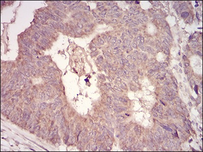 Anti-TRIM63 Antibody (5C208)