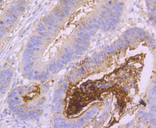 Anti-Mucin-2/MUC2 Antibody (9V575)