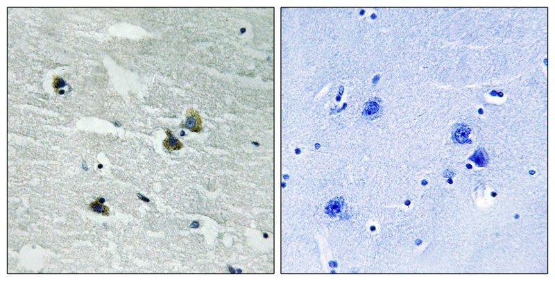 Anti-Phospho-Mer/Dtk (Tyr749/681) Polyclonal Antibody