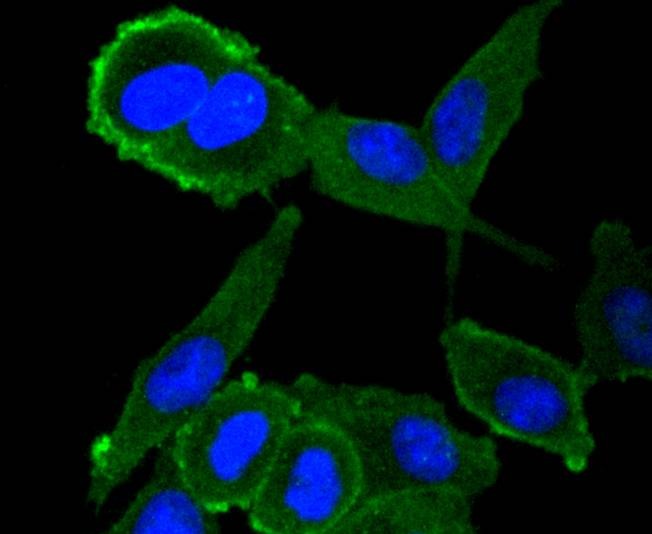 Anti-Moesin Antibody (2Z70)