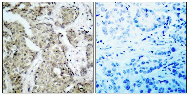 Anti-Phospho-MKK6 (Ser207) Polyclonal Antibody