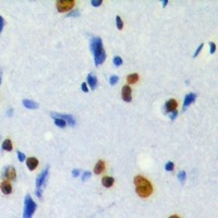 Anti-Phospho-MKI67IP (Thr234) Polyclonal Antibody