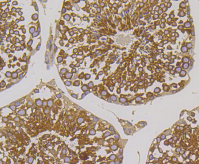 Anti-METAP2 Antibody (2D279)