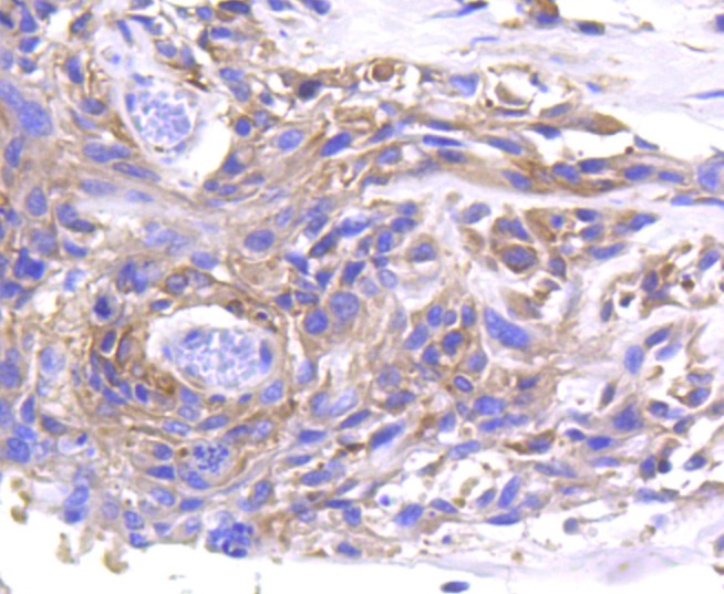 Anti-MMP11 Antibody (2X863)