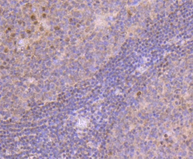 Anti-MGMT Antibody (6G140)