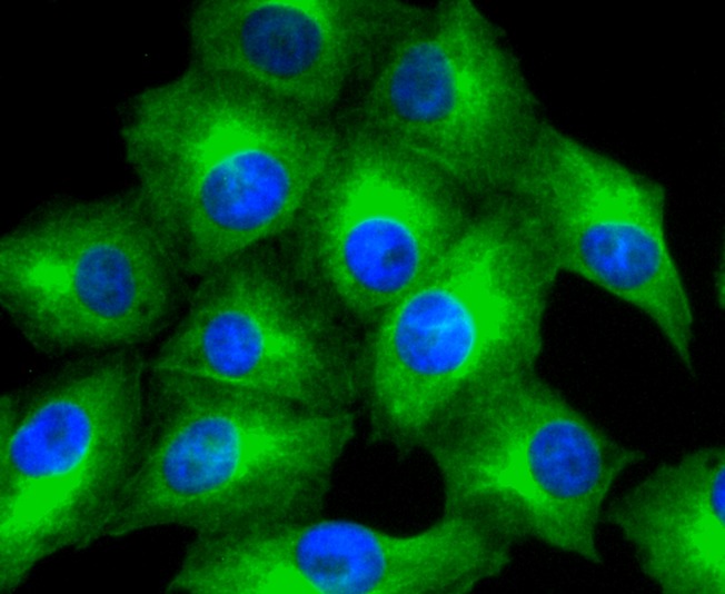 Anti-MMP11 Antibody (2X863)